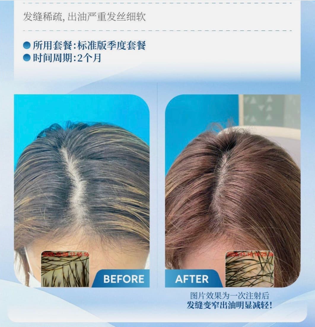 发缝变宽改善前后对比